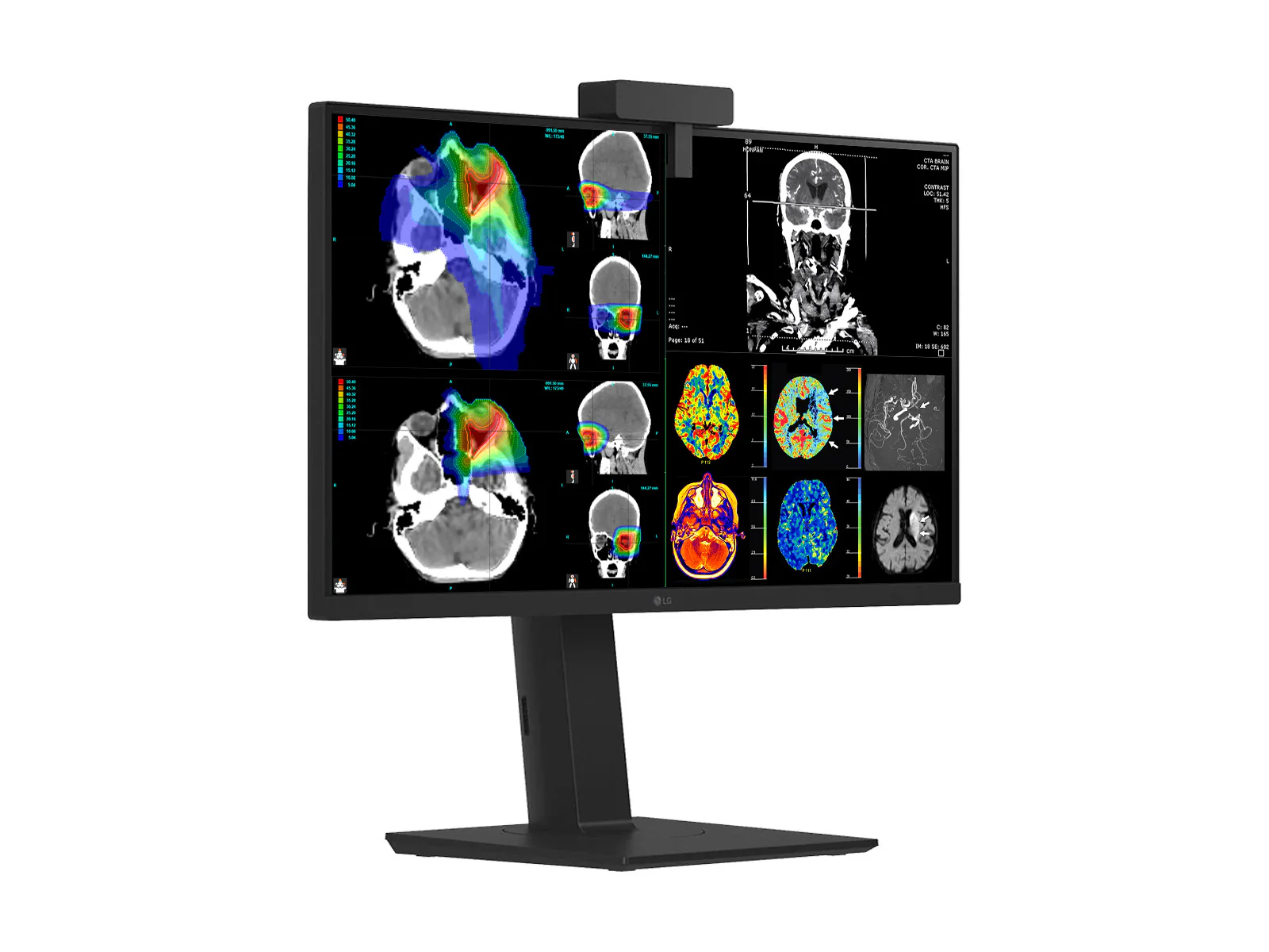 LG 27" 27HS713C Fusion 8MP 4K Clinical Review Medical DICOM Display Monitor - Image 6
