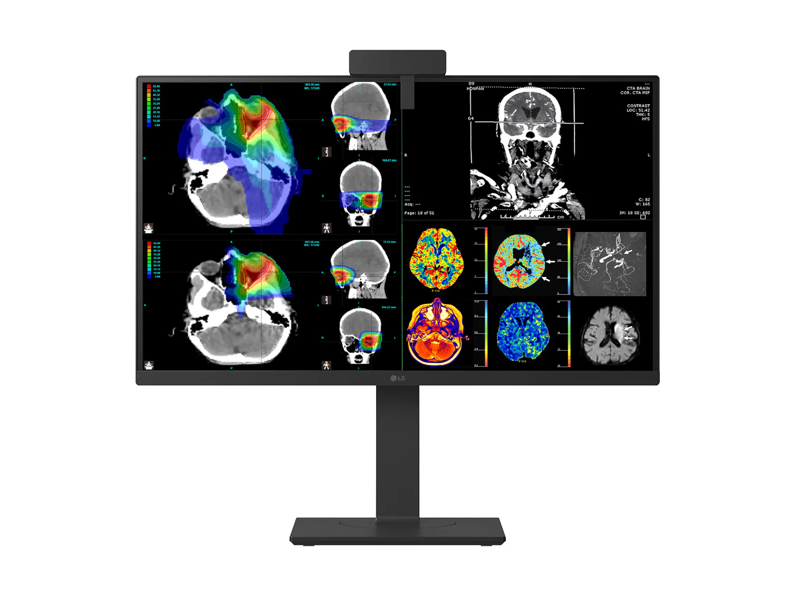 LG 27" 27HS713C Fusion 8MP 4K Clinical Review Medical DICOM Display Monitor - Image 7
