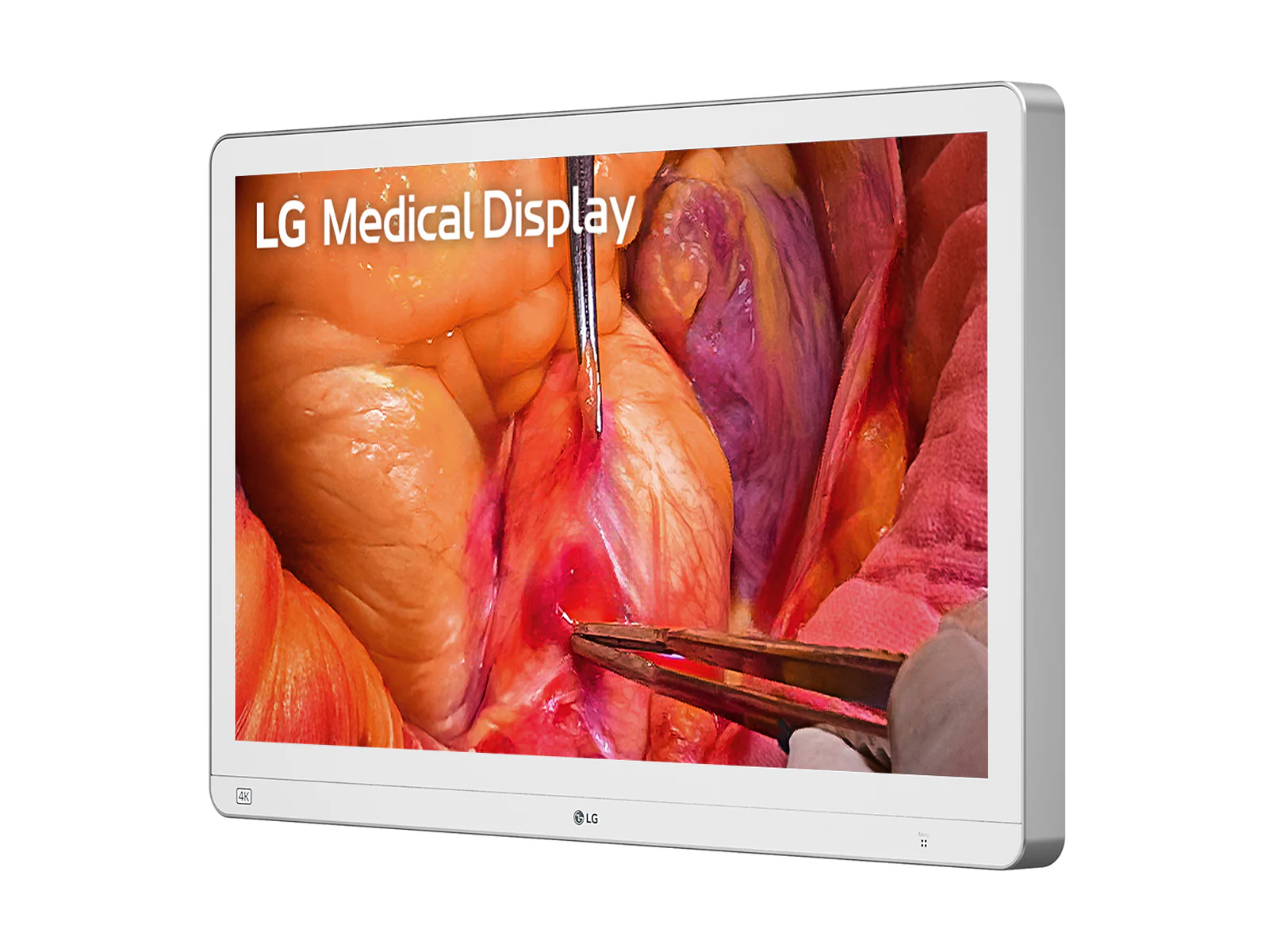 LG 27" 27HS714S-W 4K Mini-LED 12G SDI Surgical Endoscopy Medical Display Monitor - Image 2