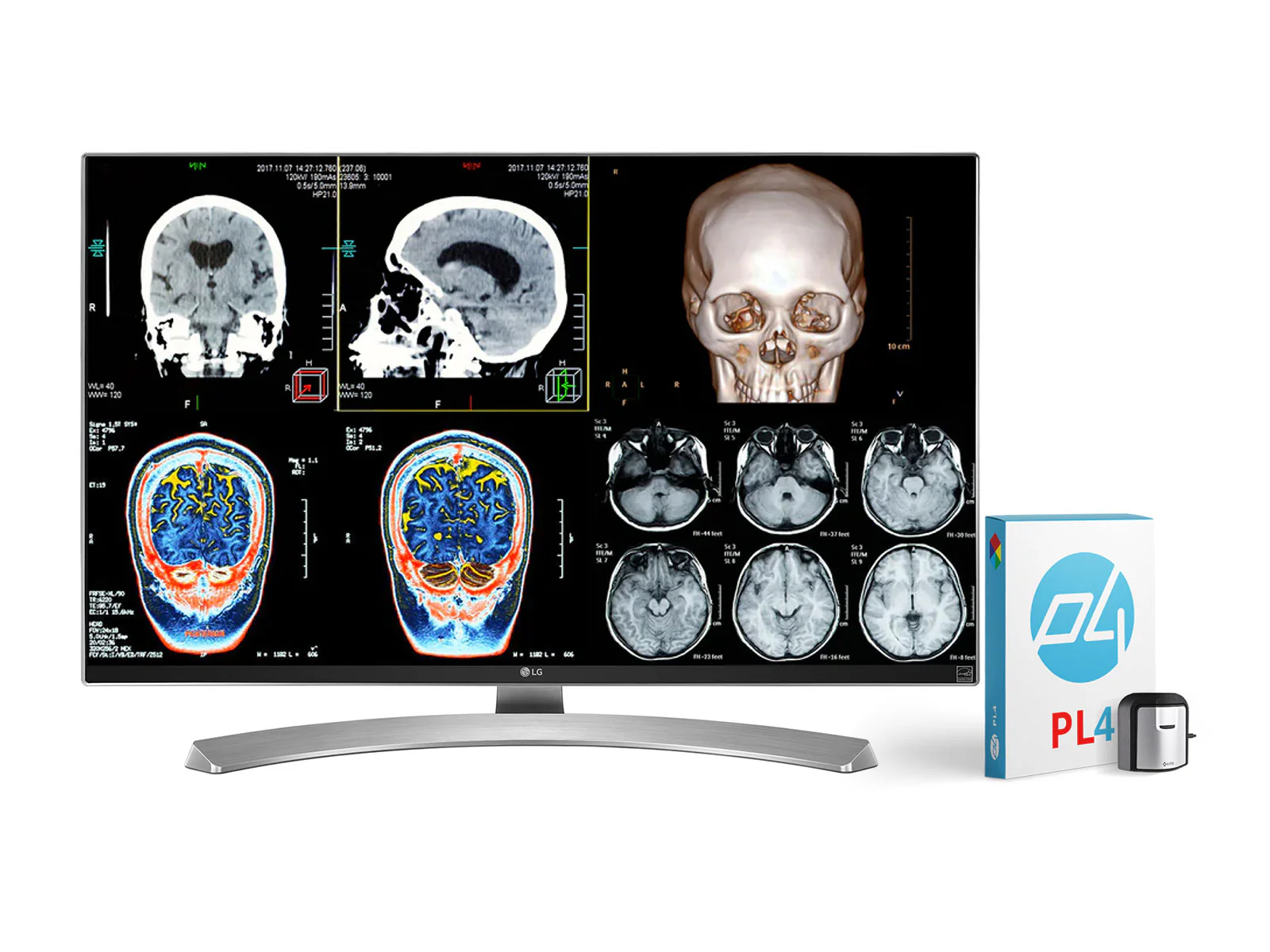 LG 4K 8MP 27" Color Clinical Review Medical Display Monitor - Image 3