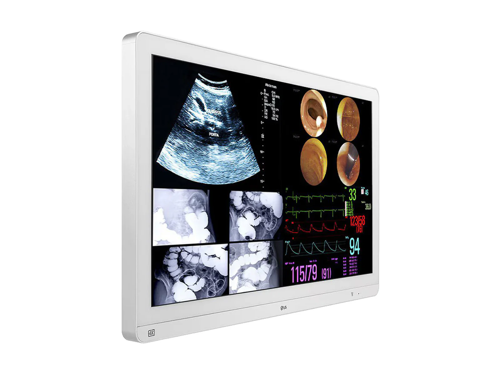 LG 31.5" LED 4K IPS 12G SDI Surgical Endoscopy Display Monitor (32HL714S-W) - Image 2