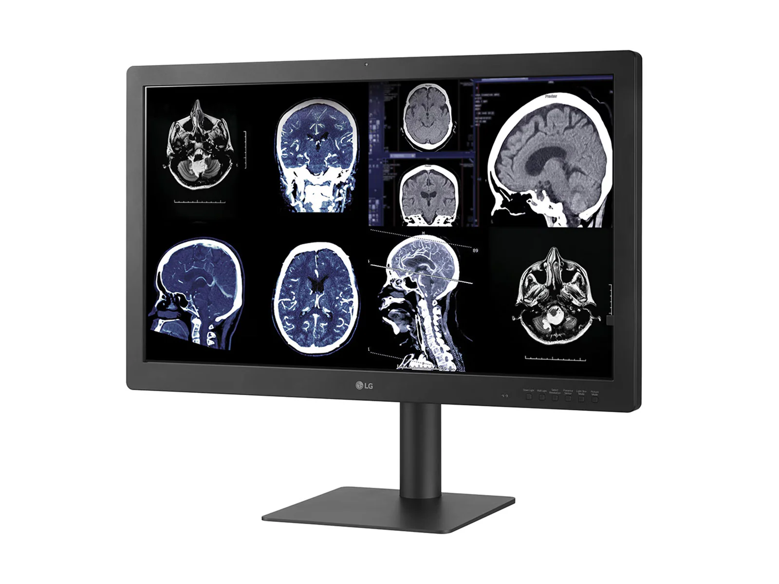 LG 32HQ713D-B 8MP 32" Diagnostic Fusion Color Medical Radiology PACS Monitor - 1000 cd/m² DICOM Brightness - Image 2