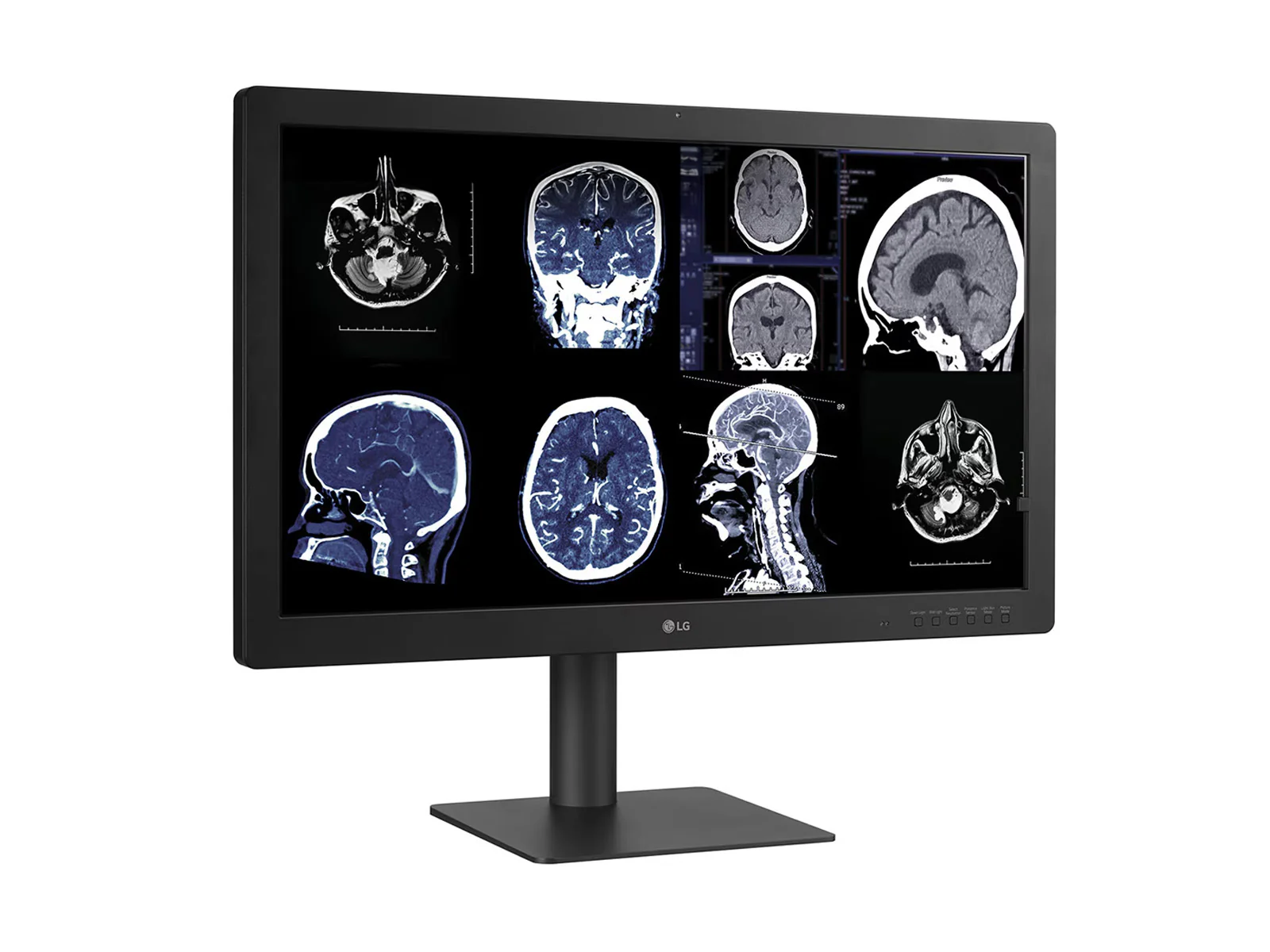 LG 32HQ713D-B 8MP 32" Diagnostic Fusion Color Medical Radiology PACS Monitor - 1000 cd/m² DICOM Brightness - Image 8