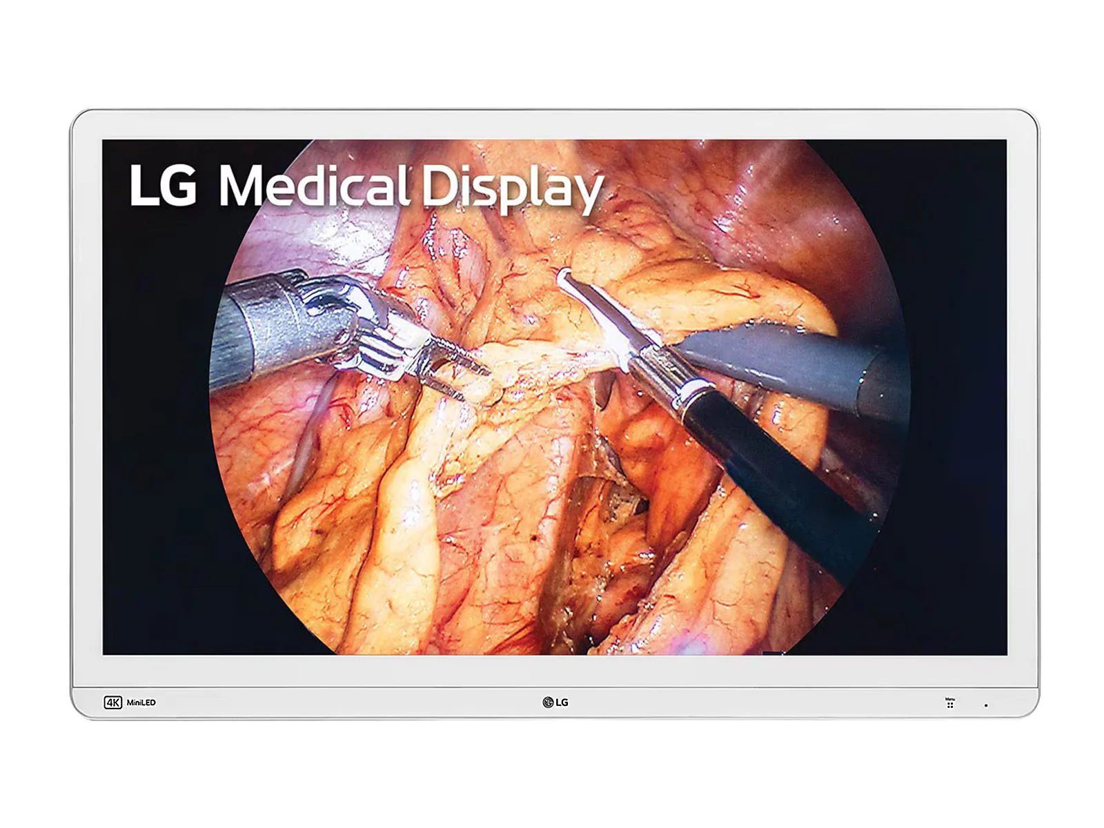 LG Mini-LED 31.5" 32HR734S-W 8MP 4K UHD 12G SDI Surgical Endoscopy Medical Display Monitor