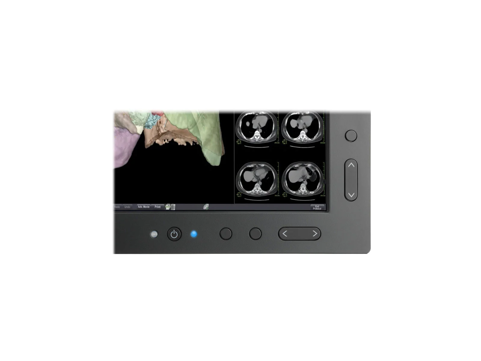NEC MultiSync MD301C4 4MP 30" General Radiology PACS Display (MD301C4) - Image 3