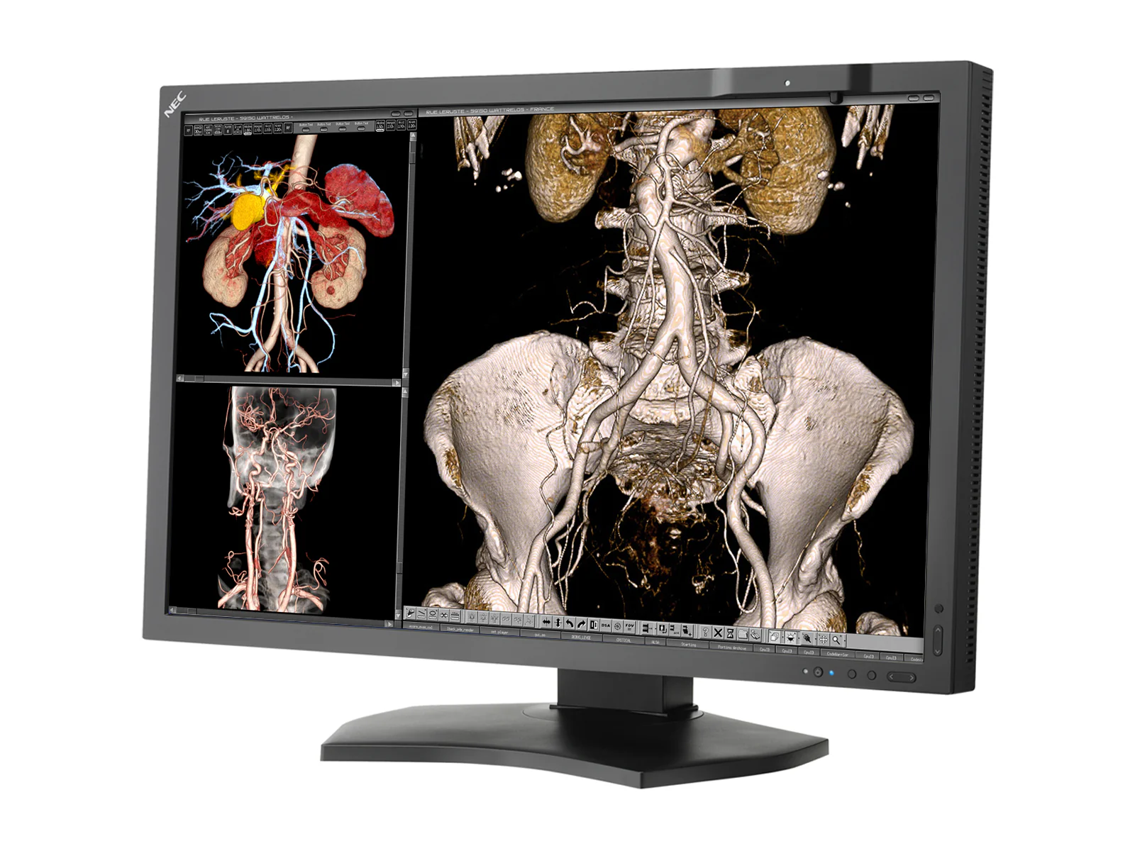 NEC MultiSync MD302C4 4MP 30" General Radiology PACS Display (MD302C4) - Image 2
