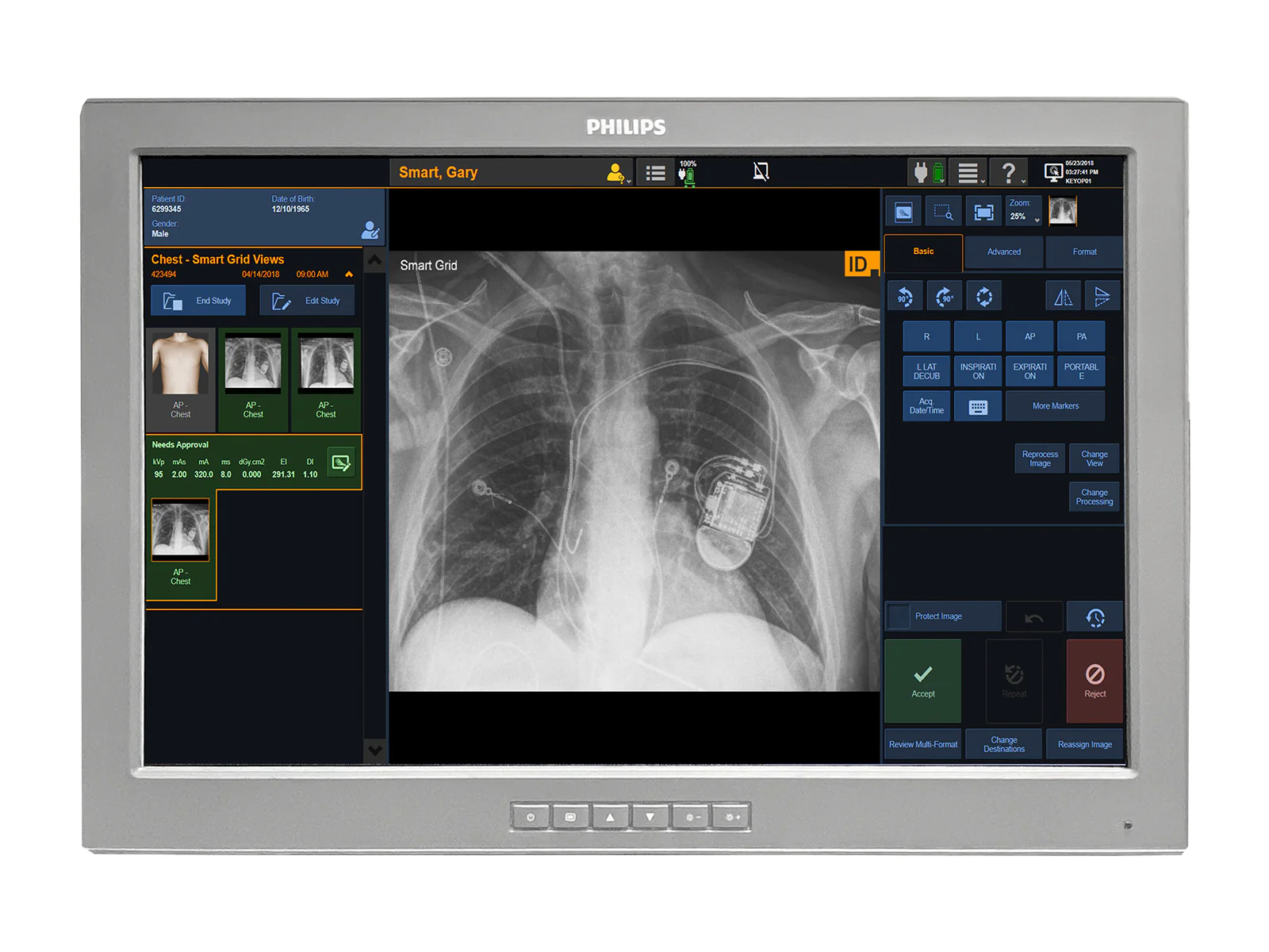 Barco P240-LAv MED24ESB 24" 2MP Philips DICOM Surgical Display Monitor by Fimi Barco (P240-LAv)