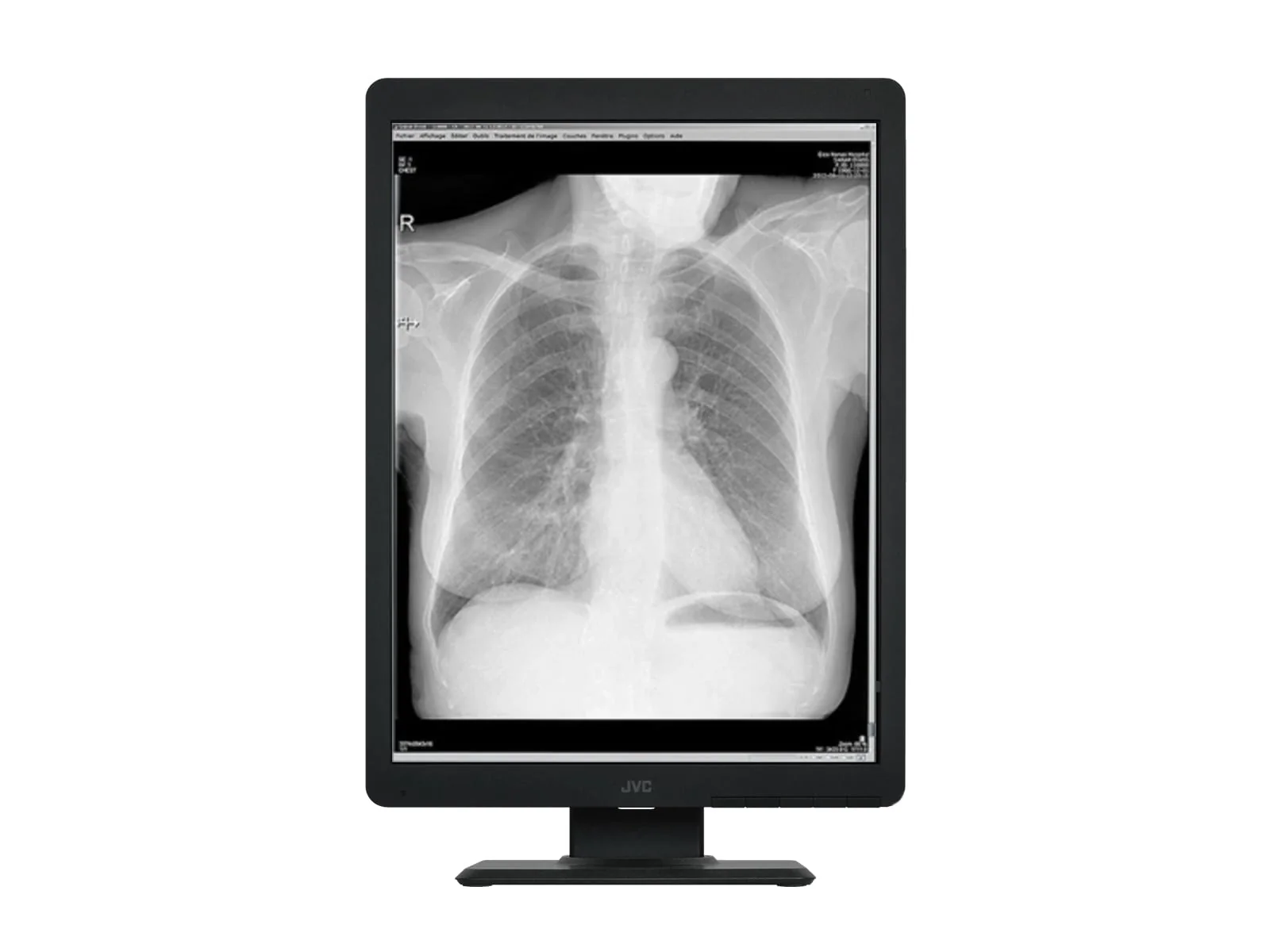 Vidar DiagnosticPro Edge General Radiology & Mammography Film Digitizer (19580-001) - Image 4